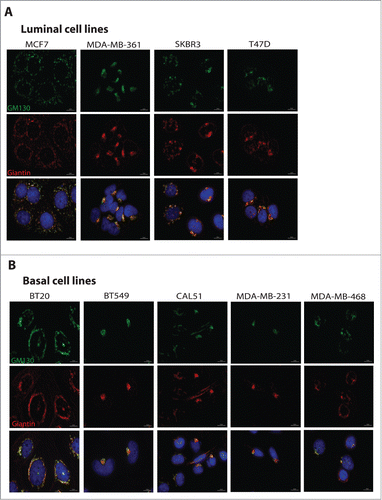 Figure 3 Cells were plated on coverslips and processed for immunofluorescence staining using antibodies against GM130 (green) and Giantin (red) to visualize the Golgi, and DAPI to stain the nuclei. Scale bars, 10 μm. (A) Representative images of Golgi in luminal cell lines. (B) Representative images of Golgi in basal cell lines.