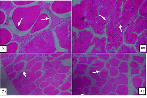 Figure 1. Microstructure of skeletal muscle of heat-stressed (A) and taurine supplementation at the level of 2.5 (B), 5 (C) and 7.5 g/kg (D) in broilers (×40).
