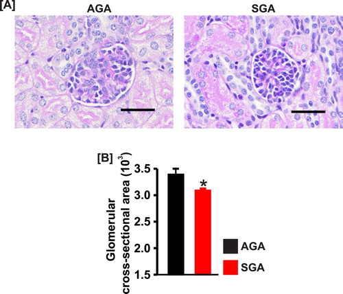 Figure 2. (a) Kidney section images (PAS staining) and (b) bar graphs showing the mean glomerular cross-sectional area in AGA and SGA newborn pigs (n = 5 each). *P < 0.05 vs. AGA; scale bar = 50 µm.