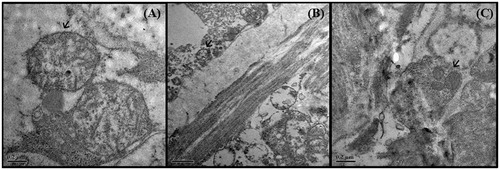 Figure 7. TEM of mitochondria (→) of R. tetragona: (A) control showing mitochondria with defined cristae and smooth membrane, scale bar 0.2 μm; (B) worms treated with C. viscosum and (C) PZQ showing fuzzy mitochondira; Scale bar 0.5 μm and 0.2 μm, respectively.