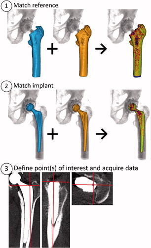 Figure 1. CTMA basic workflow. Step 1: identify the reference body (femur) in both postoperative CT and follow-up CT. The resulting computer-generated blue/red/green color scale indicates how well the computer matched postoperative and follow-up. Step 2 repeats the process but now for the moving body (stem). In the 3rd and final step one or several points of interest are defined. These are the points for which data is to be reported. Definition of a custom coordinate system can also be done in the same step. Data acquisition includes migration quantification as well as moving images.