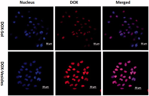 Figure 5. Internalization and accumulation of DOX in Hela cells were conducted with DOX-Sol or DOX-vesicles for 4 h, measured by confocal microscopy. Scale bar is 50 µm.