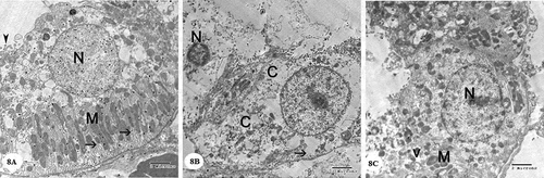Figure 8. Electron micrographs of a portion of the distal convoluted tubule: (A) Control group showing that the cell has an euchromatic nucleus (N), basal infoldings of the cell (arrows) with longitudinally arranged mitochondria (M), few apical blunt microvilli (arrowhead). (B) Gentamicin treated group showing that the cell has condensed nucleus (N), the cytoplasm(c) appears rarified with many vacuoles and loss of basal infoldings (arrow) and most of cytoplasmic organelles. . (C) Gentamicin and AGE cotreated group showing that the cell has an euchromatic nucleus (N), mitochondria (M) and some vacuoles(v) in the cytoplasm could be seen. (x 4800)