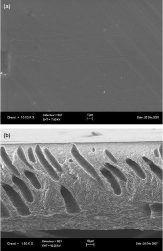 Figure 4 SEM image of the skin (a) and of the cross section (b) of the membrane obtained with 20% w/w CA, 6% LiCl and methyl lactate as a solvent.