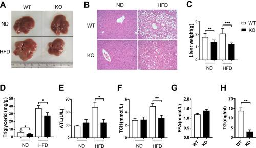 Figure 2 Hepatic steatosis was decreased in Bcl3-KO mice.