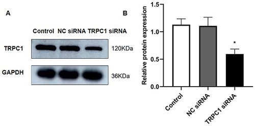 Figure 6 The efficiency of knockdown in TRPC1 expression by TRPC1 siRNA was determined by Western blot analysis. Western blotting of TRPC1 in each group in 16HBE cells (A). Relative ptrotein expression of TRPC1 measured by Western blotting (B). All values were represented as means ± SD. (N=3). * P<0.01 vs the control group.