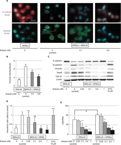 Figure 3 Coculture with HPMCs induces EMT-like changes in MKN-45 cells that are diminished by pretreatment with eribulin.Notes: (A) Immunofluorescence staining of E-cadherin (red) and vimentin (green) (original magnification of 400×). (B) Quantitative evaluation of mean vimentin intensity in immunofluorescence images. (C) Western blotting of E-cadherin, N-cadherin, vimentin, Snail2, and TGF-β1; β-actin was used as a loading control. (D) Densitometry analyses of vimentin expression were performed from three independent experiments. (E) Invasion assay using Matrigel invasion chambers. Values shown are means ± SD of three experiments. **p<0.01 vs control (MKN-45 + HPMCs, 0 nM eribulin), *p<0.05, ***p<0.01 vs control (MKN-45, 0 nM eribulin), #p<0.05, ns: not significant.Abbreviations: EMT, epithelial–mesenchymal transition; 5-FU, 5-fluorouracil; HPMCs, human peritoneal mesothelial cells; TGF-β, transforming growth factor-β.