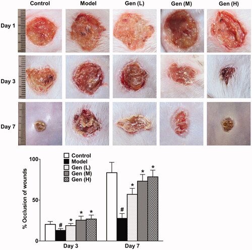 Figure 2. Geniposide promoted wound healing dose-dependently on day 1, 3 and 7 after continuous administration. Data are shown as means ± SEM (n = 4–5 in each group with total of 23 rats). #p< 0.05 and *p< 0.05 denote statistical significance compared with normal control group and the model group, respectively, analysed by one-way ANOVA followed by the post hoc Student–Newman–Keuls test.