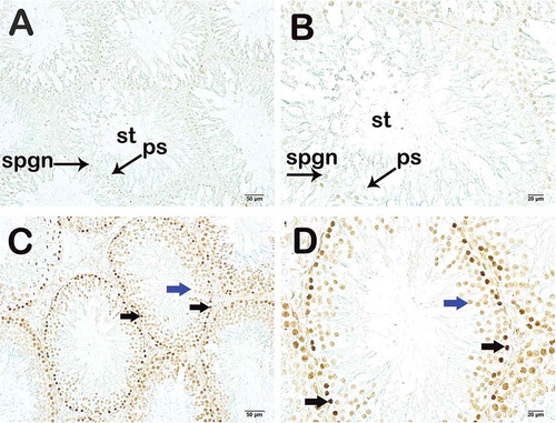 Figure 4. Light microscopy image of TUNEL staining. (A) (x200) – (B) (x400). Unirradiated group sections show normal spermatogonium (spgn) and primary spermatocytes (ps). Seminiferous tubule (st). (C) (x200) – (D) (x400). Irradiated group sections show apoptotic spermatogonium (black arrow) and primary spermatocytes (blue arrow).