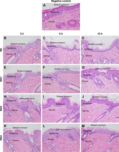 Figure 10 Skin histological cross sections 2, 6, and 12 h after application of the NE and NGs.Notes: NG1, NG2, NG3: NE gels containing 1%, 2%, and 3% (w/w) Carbopol® 934, respectively. All figures were magnified 200 fold. (A) Normal structure of skin, (B–D) the structure of skin treated with NE, (E–G) NG1, (H–J) NG2, and (K–M) NG3 at time intervals 2, 6 and 12 h, respectively.Abbreviations: NE, nanoemulsion; NG, NE gel.