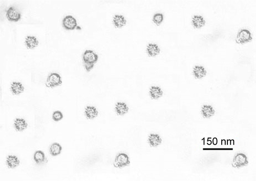 Figure S2 The TEM image of insulin/chitosan.
