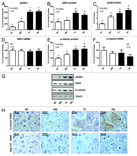 Figure 4. Expression of GSK3β and β-catenin in the liver of GH-overexpressing transgenic mice and normal controls. Liver extracts from young adult normal female (NF), normal male (NM), GH-transgenic female (TF) and GH-transgenic male (TM) mice were analyzed by immunoblotting to determine the phosphorylation and protein content, or by reverse-transcriptase quantitative PCR (qRT-PCR) to assess mRNA levels. (A) Phosphorylation of GSK3β at Ser9 (pGSK3β). (B) GSK3β protein content. (C) Phosphorylated GSK3β levels corrected by GSK3β protein content. (D) GSK3β mRNA levels. (E) β-catenin protein content. (F) β-catenin mRNA levels. Results are expressed as % of the mean values in normal female mice. Data are the mean ± SEM of nine sets of different individuals per group (n). Different letters denote significant difference at p < 0.05. NS: not significant. (G) Representative results of immunoblots are shown. Reprobing with anti-STAT5 antibody demonstrated similar protein loading in all lanes. (H) Immunohistochemical staining of liver sections with anti-β-catenin: representative microphotographs are shown. Negative controls were performed in parallel on additional slides and incubated with PBS instead of primary antibody.