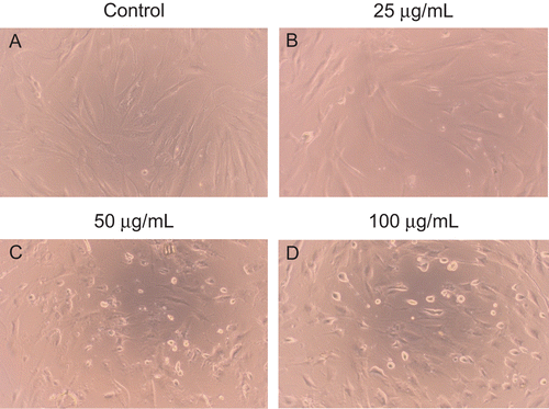 Figure 4.  The morphological alterations to HSFs treated with indicated concentrations of EO for 12 h. (A) Little cell death was observed in the control group. (B–D) The number of cell death significantly increased in a dose-dependent manner when HSFs were treated with 25, 50 and 100 μg/mL EO for 12 h. Cell morphology was assessed using an Olympus inverted phase-contrast microscope with an Olympus C-5060 digital camera. The morphological alterations to HSFs treated with EO for 24 and 48 h were not displayed.