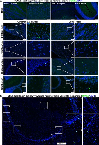 Figure 7. TUNEL staining in the brain tissues of newly-weaned hamsters infected by Omicron BA.2 or Delta virus at 7 dpi. (A) Representative images of different brain structure stained by TUNEL. Mock control hamster brain, from left to right, OB, cerebral cortex, hippocampus, and cerebellum showed no TUNEL labelled cells. TUNEL staining images of Omicron BA.2 (left two panels) and Delta (right two panels) infected newly-weaned hamsters brain tissue at 7 dpi showing TUNEL-positive cells (in green). Positive cells in the squared area were magnified and shown on the right. Scale bar = 100 µm. (B) Representative images of increased TUNEL-positive ependymal cells lining the lateral ventricle in newly-weaned hamster brain after Omicron BA.2 infection at 7 dpi. Positive cells in numbered squared areas were magnified and shown on the right. Scale bar = 200 µm.