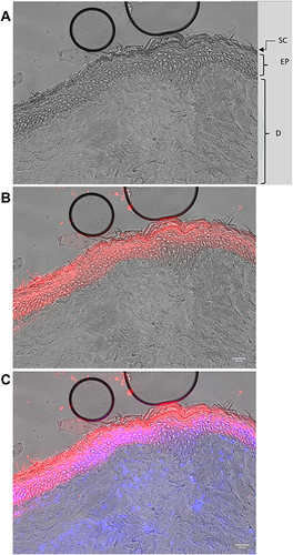 Figure 8 (A) Cross section of the skin sample. (B) Confocal image of encapsulated antioxidant complex liposomes (red) after penetration in a skin sample (grey) and (C) Confocal image of encapsulated antioxidant complex liposomes (red) after penetration in a skin sample (grey) stained with DAPI (blue).