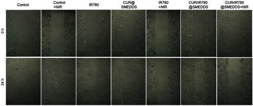 Figure S5 Photographs of the wound healing assay with 4T1 cells treated with control, IR780, CUR@SMEDDS, CUR/IR780@SMEDDS, control+NIR, IR780+NIR, and CUR/IR780@SMEDDS+NIR.