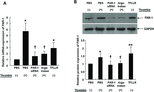 FIGURE 1  Cells were either treated with 2 U/mL thrombin for 4 hours with or without pretreatment with 60 mM PAR-1 siRNA or 1 μM argatroban for 30 minutes. A549 cells were transfected with PAR-1 siRNA using transfection reagent for 6 hours at 37°C, washed using 2x normal growth media containing antibiotics and incubated in 1x normal growth media. Cells were also treated with 300 μM TFLLR for 4 hours for real-time PCR (A). PAR-1 protein levels were determined by immunoblotting after same treatments for 72 hours (B). Thrombin and PAR-1 activating peptide, TFLLR increased PAR-1 mRNA expression in A549 cells by quantitative real-time PCR. PAR-1 siRNA transfection or pre-treatment of thrombin inhibitor, argatroban, suppressed thrombin-induced PAR-1 mRNA expression (A). Thrombin and TFLLR increased PAR-1 protein expression as assessed by Western blot. PAR-1 siRNA transfection or pretreatment with argatroban inhibited thrombin-induced PAR-1 protein expression (B). Data are presented as means ± SE; n = 5/group. *, † P < .05; **P < .01. *, **; compared with control. †; compared with thrombin.