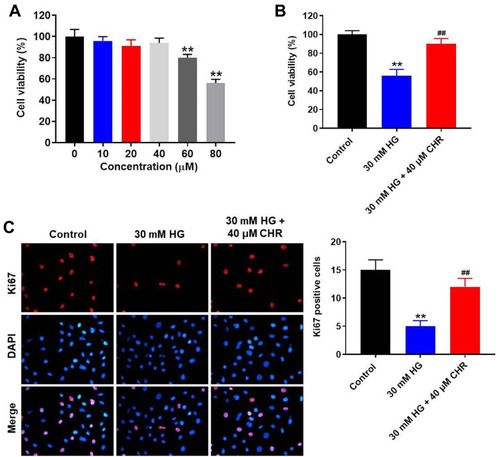 Figure 1 HG-induced AB8/13 cell growth inhibition was significantly reversed by CHR. (A) AB8/13 cells were treated with 10, 20, 40, 60 or 80 μM CHR. Then, cell viability was tested by CCK-8 assay. (B) AB8/13 cells were treated with 30 mM HG or 30 mM HG + 40 μM CHR. Then, cell viability was tested by CCK-8 assay. (C) The proliferation of AB8/13 cells was measured by Ki-67 staining. Red fluorescence indicates Ki-67. Blue fluorescence indicates DAPI. **P < 0.01 compared to control. ##P < 0.01 compared to 30 mM HG.