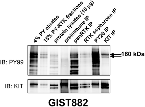 Figure 1. Validation of the phosphotyrosine (PY) and RTK immunoaffinity double purification approach in GIST882 by immunoblot. Total protein lysate (input) is included as a control. KIT, panRTK, PY, and RTK-sepharose IPs are positive controls. Pre-immune IP is a negative control. PY staining after double purification (PY immunoaffinity column followed by panRTK IP) shows a doublet representing the known KIT oncoprotein. The presence of KIT was corroborated by mass spectrometry analysis.