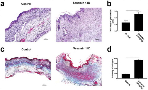 Figure 9. Sesamin increased granulation thickness and enhanced collagen deposition and remodeling.