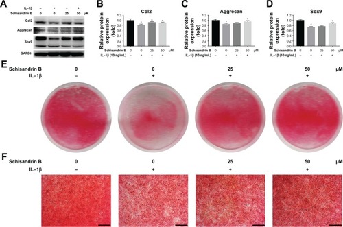 Figure 3 Effect of Schisandrin B on IL-1β-induced cartilage phenotype loss in rat chondrocytes.