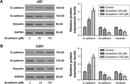 Figure 3 Scutellarin reversed the epithelial-mesenchymal transition phenotype in glioma cells.Notes: After treatment with or without scutellarin for 48 hours, Western blot analysis was performed to detect the expressions of E-cadherin, N-cadherin, and vimentin in U87 (A) and U251 cells (B). *P<0.05 vs control. Data are represented as mean ± SD of three independent experiments.