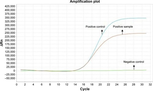 Figure 2 Amplification plot of EML4-ALK-positive by amplification refractory mutation system method.