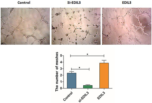 Figure 5 Effect of EDIL3 on the tube formation capacity of ECs in vitro. Quantification of the numbers of mesh in different groups to show their tube formation ability. The recombinant EDIL3 protein significantly increased the tube formation ability of ECs. EDIL3 silencing decreased the number of meshes. (*p < 0.05 was considered significant).