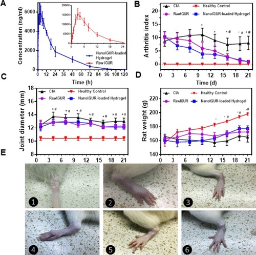 Figure 5 Changes in body weight, ankle joint diameter, and AI scores after drug intervention in CIA models. Comparision of drug concentration–time curve in healthy rats of raw IGUR and NanoIGUR-loaded hydrogel (A); changes in the arthritis index of rats during drug intervention (B); changes in the joint diameter in rats during drug intervention (C); changes in the weight of rats during drug intervention (D); (E) ❶: Induction of collagen-induced arthritis (CIA) model by intradermal infection of bovine type II collagen emulsion; ❷: Swollen joints of CIA model rats; ❸: Ankle joints in healthy rats; ❹: CIA model without any drug intervention showing obvious joint deformity 21 days after the onset; ❺: CIA model rat treated with raw IGUR for 21 days; ❻: CIA model rat treated with NanoIGUR-loaded hydrogel for 21 days. Data represent three independent experiments (mean ± SD), n = 7 per group. *p < 0.05, compared with NanoIGUR-loaded hydrogel, # p < 0.05, compared with raw IGUR.