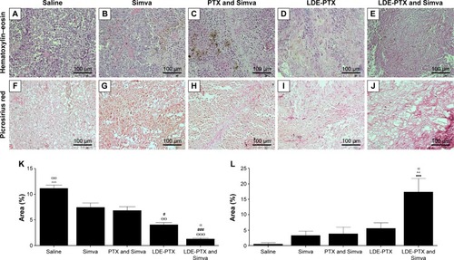 Figure 2 Histological study of tumors from melanoma-bearing mice.Notes: Mice treated with PTX oleate 17.5 μmol/kg associated with LDE + Simva 50 mg/kg; PTX oleate 17.5 μmol/kg associated with LDE; commercial formulation of PTX 17.5 μmol/kg + Simva 50 mg/kg; Simva 50 mg/kg; and saline solution 0.9% as control. Animals were intraperitoneally injected with chemotherapy on days 11, 14, and 19. Simva was administered daily by gavage from day 11 to day 19. Each group comprised six animals. Representative photomicrographs from tumors stained with hematoxylin–eosin (A–E) and picrosirius red (F–J) in which the collagen stained red, magnification 200×. Photomicrographs from tumor-tissue sections were analyzed regarding tumor-cell density (K) and presence of collagen types I and III (L) with NIS-Elements 3.2 Advanced Research image-analysis software (Nikon Corporation, Tokyo, Japan), and results are presented as means ± standard error of mean: ΘΘΘvs Simva (P<0.001); ΘΘvs Simva (P<0.01); ###vs PTX and Simva (P<0.001); #vs PTX and Simva (P<0.05); αvs LDE-PTX (P<0.05); ^^^vs all the other groups (P<0.001); ^^vs all the other groups (P<0.01); •••vs saline (P<0.001).Abbreviations: PTX, paclitaxel; LDE, lipid nanoemulsion; Simva, simvastatin.