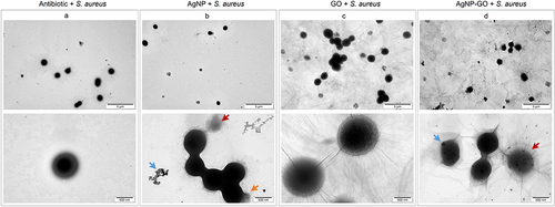 Figure 4 Transmission electron microscopy visualization of bacteria (Staphylococcus aureus) after incubation with (a) antibiotic (positive control), (b) silver nanoparticles (AgNP), (c) graphene oxide (GO), and (d) their complex (AgNP-GO). The blue arrow indicates AgNPs, and the red arrow indicates examples of dead bacterial cells. The orange arrow shows cytoplasm leakage from the bacterial cell.