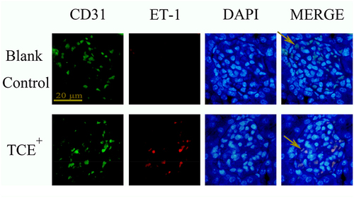 Figure 14 The location of ET-1 (×400). ET-1 was mainly expressed on endothelial cells. Yellow arrow: endothelial cells.