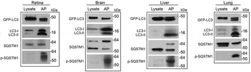 Figure 1. Enrichment of autophagosome markers in autophagosomes isolated from GFP-LC3 mouse tissues. Immunoisolated autophagosome fractions from retina, brain, liver and lung of GFP-LC3 mice were compared with corresponding post-nuclear supernatant fractions of the cell lysates. Note the increase in the amount of autophagosome-related proteins, LC3 (endogenous and GFP-LC3), SQSTM1, and Ser403-phosphorylated-SQSTM1 in the autophagosome fraction (AP) versus the cell lysate. Note that the material for the lysate lanes are taken from the whole cell (post-nucleus removal) without discarding cytosolic LC3, whereas the immunoprecipitation products were from the pellet after removing the cytosolic LC3. As GFP-LC3 is very abundant in the whole cell lysate, the amount of protein loaded into the lysate versus AP lanes are different, so as not to oversaturate the lysate lane. Thus, it appears as if GFP-LC3 is not being enriched. The enrichment of the endogenous LC3, however, helps serve as an internal control for the enrichment. For the immunoblots, 8 µg protein of tissue lysate was loaded. The volume of enriched autophagosome (from a total volume of 50 µL in protocol step 3.3.8) loaded were: 8 µL for retina, 4 µL for brain, 6 µL for liver and 10 µL for lung. Antibodies: LC3A/B (1:1000; Cell Signaling Technology, 4108); SQSTM1 (1:1000; Novus Biologicals, NBP1-48320S); p-SQSTM1 (1:400; Gene Tex, GTX128171).