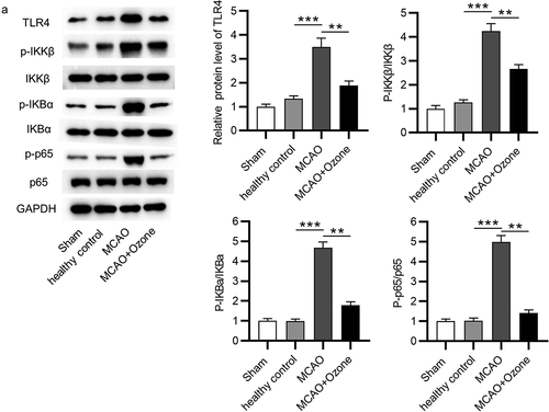 Figure 5. Ozone inactivated the NF-κB signaling pathway. (A)Western blot analysis was utilized to detect expression levels of the NF-κB signaling pathway associated proteins including TLR4, p-IKKβ, IKKβ, p-IKBα, IKBα, p-p65, and p65 in hippocampal tissues of rats in the sham group, the healthy control group, the MCAO group, the MCAO + ozone group. N = 12 in each group. **p < 0.01, ***p < 0.001.