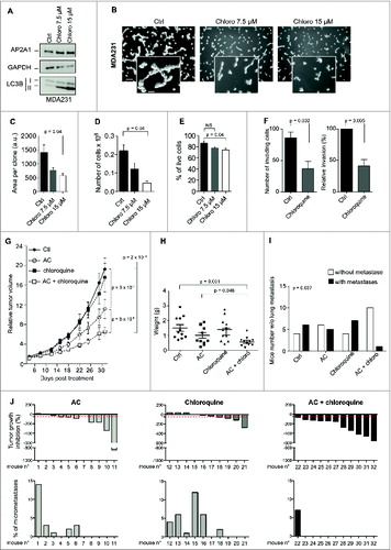 Figure 7. For figure legend, see page 2136. Figure 7 (See previous page). Chloroquine potentiates chemotherapy in a PDX model of high-LC3B TN BC. (A) Western blots showing LC3B-I/-II protein levels in MDA231 TN BC cell line untreated (Ctrl) or treated for 3 d with 2 doses of chloroquine (Chloro; 7.5 or 15 μM), as indicated. AP2A1 and GAPDH are used as internal controls for protein loading. (B) Representative bright field images of MDA231 TN BC cells cultured in 3D conditions. Cells are either treated with PBS (Ctrl) or treated with 2 doses of chloroquine, as indicated. Scale bars = 100 μm, (low magnification) and 50 μm (high magnification). (C) The bar graph represents the total area per clone upon chloroquine treatment, as determined using Metamorph software. Data are shown as means +/− sem (N = 3 independent experiments). p-values are based on the Student t test. (D,E) Bar graphs show the total number of cells (D) and the percentage of live cells, as assessed by trypan blue-negative cells, (E) after 3 d of 3D culture. Results are from MDA231 cells either treated with PBS (Ctrl) or treated with 2 doses of chloroquine, as indicated. Data are shown as means +/− sem (N = 3 independent experiments). p-values are based on Student t test. (F) Invasion assay using a BioCoatTM MatrigelTM Invasion Chamber from MDA231 cells, either untreated (Ctl) or treated with (50 μM) of chloroquine overnight. Left histogram: Numbers of invading cells, which passed through a Transwell over 6 h of incubation. Right panel: Percentage of cells, relative to siCtrl (100%), which passed through a Transwell over 6 h of incubation. (G) Tumor growth curves over time of a high-LC3B PDX model. When tumors reached 50 mm3, mice were treated either with PBS (Ctrl), AC (adriamycin and cyclophosphamide), chloroquine, or a combination of AC and chloroquine, for 31 d. Relative tumor volumes are presented as means ± sem (N ≥ 10 mice per group). p-values are based on 2-way ANOVA test. (H) Graph shows the final weight of each tumor in each group (n ≥ 10 per group). p-values are based on the Student t test. (I) The bar graph shows the number of mice without (white) or with (black) lung metastases, as assessed by the detection of human-specific Alu sequences in RNA extracted from mouse lung. N ≥ 10 animals per condition. p-value is based on Fisher's exact test. (J) Upper Panel, tumor growth inhibition (defined as % of tumor volume before treatment) is shown for each mouse following AC treatment, administration of chloroquine alone or a combination of AC + chloroquine, as indicated. Lower Panel, quantification in each mouse of lung colonization by tumor cells. Lung colonization was quantified by the detection of human-specific Alu sequences. Lung metastases are quantified after 31 d of treatment with AC, chloroquine or AC + chloroquine, as indicated. N ≥ 10 tumors for each condition. Numbers below each graph represents the tag number of each mouse.