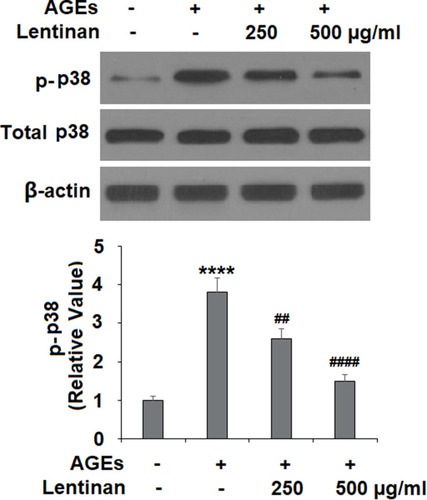 Figure 6 Lentinan inhibited AGE-induced activation of p38. Cells were stimulated with 100 μg/mL AGEs with or without lentinan (250 and 500 µg/mL) for 2 h. Phosphorylated and total levels of p38 were measured (****, P<0.0001 vs vehicle group; ##, ####, P<0.01, 0.0001 vs AGEs treatment group, n=4-5).