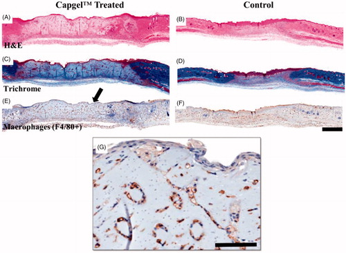 Figure 3. Representative d7 histological images of control (saline) and well-integrated Capgel™-treated wounds. (A, B) H&E staining, (C, D) Trichrome staining and (E-G) immunohistochemical F4/80 staining; Capgel™-treated wounds showed a larger wound bed that resisted contracture compared to saline controls as evident by the edges of the panniculus carnosus muscle. Arrows indicate location of photo inset. (G) Inset, lining of Capgel™ with infiltrating host cells. Scale bar =1 mm (whole tissue), 100 µm (inset).