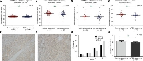 Figure 1 The mRNA and protein level of eIF4E in ccRCC.Notes: The mRNA expression level of eIF4E in ccRCC was measured. Four mRNA datasets were used including GSE40435 (A), GSE46699 (B), GSE15641 (C) and GSE66272 (D). The protein expression level of eIF4E in 101 ccRCCs was measured using immunohistochemical staining. Representative adjacent normal renal tissues’ staining (E), ccRCC tissues’ staining (F), frequency distributions of protein expression across the cohort (G) and the average score of immunohistochemical staining for eIF4E (H) are shown. (E and F) Magnification ×100.Abbreviations: ccRCC, clear cell renal carcinoma; eIF4E, eukaryotic translation initiation factor 4E; IHC, immunohistochemistry; NS, not significant.