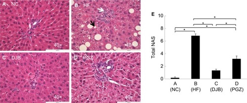 Figure 2 H&E staining of liver tissue after the 6-month protocol.