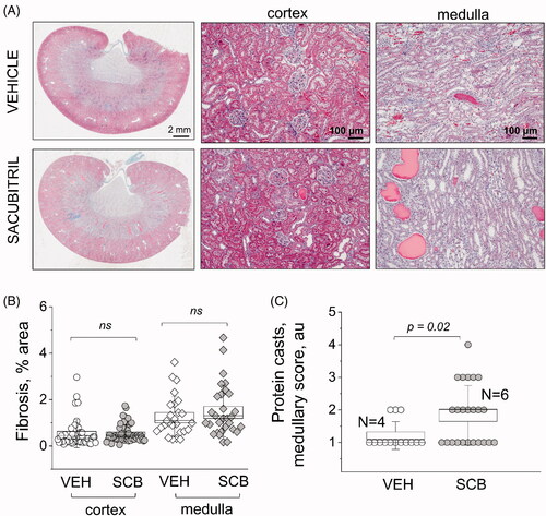 Figure 3. Histological characterization of renal damage with Masson trichrome staining. (A) Representative images of cortical and medullary renal tissues from experimental rats isolated at the end point of the experimental protocol [high-salt diet, upon administration of vehicle (VEH) or sacubitril (SCB)]. The first column shows scans of coronal midsections of kidneys stained with Masson trichrome; fibrotic tissue appears blue. The second and third columns demonstrate representative images taken in the cortexes and medulla, respectively. (B and C) graphs summarizing the analysis of percentage of fibrosis (B) and protein cast scoring (C). a.u., arbitrary units. Two-way ANOVA with Tukey post-hoc was used for significance comparisons. Each point on the graphs denotes data obtained from one image, with 16 images being taken per kidney: 10 from each cortex, and 6 from each medulla. p values are shown for comparisons where p < .05.