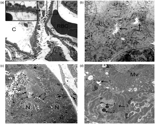 Figure 4. Electron micrographic ultrathin sections obtained from kidney of HgCl2 group. (a): Shows many capillary loops (c), RBC: red blood corpuscle. Upper left rectangle showing higher magnification of: 1-BM, 2-endothelial fensterations, P2: secondary foot processes (O.M. X12,000 & X25,000), (b): shows part of PCT. Arrow showing short few microvilli (X5000), (c): part of PCT: 1: edematous fused mitochondria, 2: ruptured cell which expels its contents in the lumen, 3: many vacuoles, 4: myeloid body, 5: lysosome, N: nuclei of tubular cells (X4000), (d): part of PCT: 1: myeloid body, 2: lysosome, 3: swollen fused mitochondria, Mv: relatively normal microvilli (X8000).