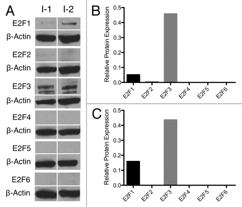 Figure 2. Insulinoma E2F expression. (A) Whole-cell protein samples from benign (I-1) and malignant (I-2) human insulinomas probed for E2F1–6 by western blot. (B and C) Insulinoma protein expression normalized to β-actin by densitomerty.