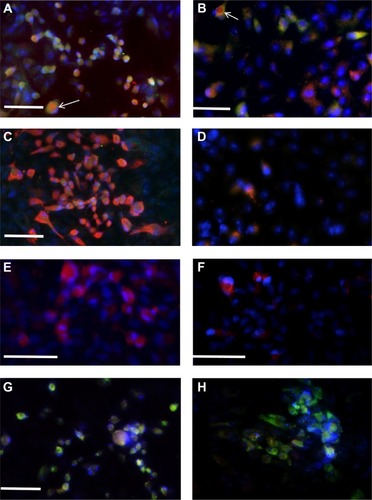 Figure 4 Immunoreactivity of tear and serum IgG (green) and IgA (red) from the AHC patient with CA24v-infected cells.