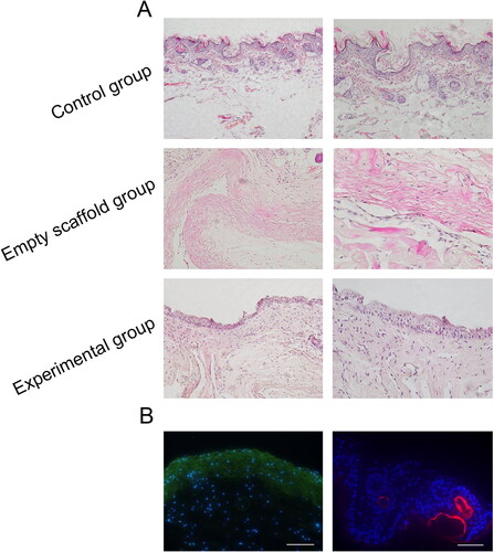 Figure 7. Histological observation of scaffold complex in vivo. (A) HE staining results displayed that epithelioid-like structure was formed in the experimental group and was thinner than the normal epithelial layer; No epithelioid-like structure was formed in the empty scaffold group and the number of cells on the tissue was small. (B) In vivo tracer experiments, EdU567 was used for VEC-like cells, EdU488 for HGECs and DAPI for HGFs. Under the microscope, the epithelioid-like structure was expressed in green fluorescence (×40), and the vascular cavity-like structure was expressed in red fluorescence. The DAPI-labelled HGFs were distributed between the epithelioid-like structure and the vascular-like structure (×200). Scale bar = 100µm.
