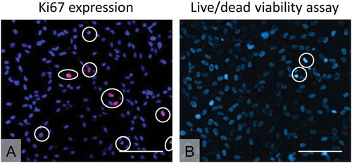 Figure 2. pCEC proliferation and viability at P2. (A) Evaluation of cell proliferation by expression of Ki67 (red, in white circles). Nuclei are stained by DAPI in blue. (B) Live-dead assay to determine cell viability (Blue: Live; Green, in circles: Dead). Scale bars: 100 µm.