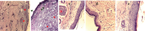 Figure 5. Histopathological examination of core injuries stained by hematoxylin and eosin (H&E) stain) (x=40) after sacrificing of rats’ and the end of experiment (a) Uninfected wound containing mild inflammation and rupture of epidermal layer (green arrow) and many blood vessels (red arrows) could be seen; (b) infected wound by S. aureus showing accumulation of bacteria along the surface of skin (green arrows) and severe irregularities and vacuoles in epidermal layer (red arrows); (c) infected wound by S. aureus treated with L. plantarum-ATCC8014 filtrate where regular surface layer of healed wound with slight irregularities in dermal layer; (d) infected wound by S. aureus treated by solution of L. plantarum-ATCC8014 lyophilized cells showing shrink healed epidermal layer as well as irregular dermal layer (e) infected wound by S. aureus treated with chloramphenicol showing regular structure of skin.