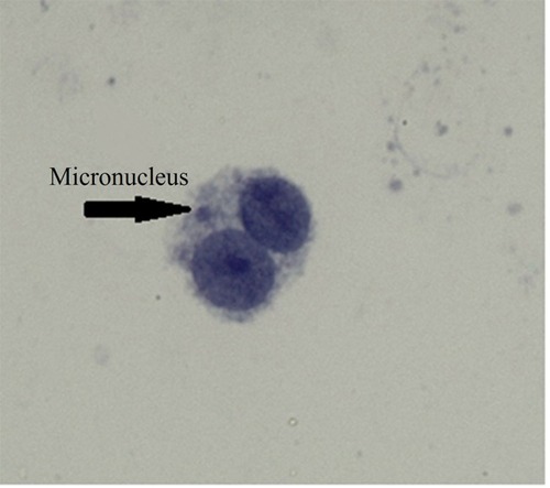 Figure 4 A typical binucleated lymphocyte with micronucleus in our experiment. The arrow shows a micronucleus.