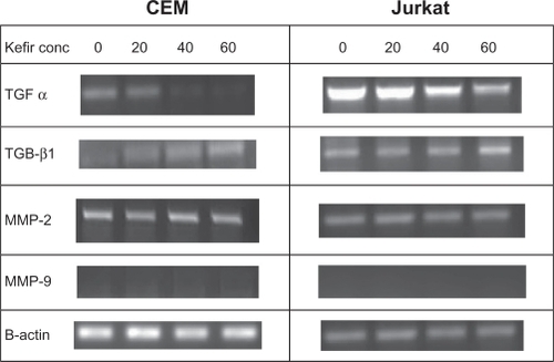 Figure 6 The effect of kefir on the transcriptional level of TGF-α, TGF β1, MMP-2 and MMP-9 in CEM and Jurkat cells.Abbreviations: Conc, concentration; MMP, matrix metalloproteinase; TGF-α, trans forming growth factor-alpha; TGF-β1, transforming growth factor-beta1.