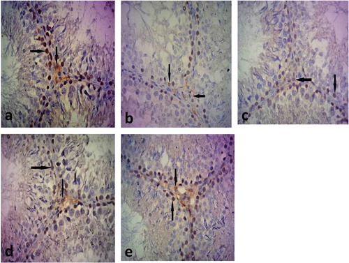 Figure 11. A photomicrograph of immunohistochemical stained sections for AR of testes of the different groups.