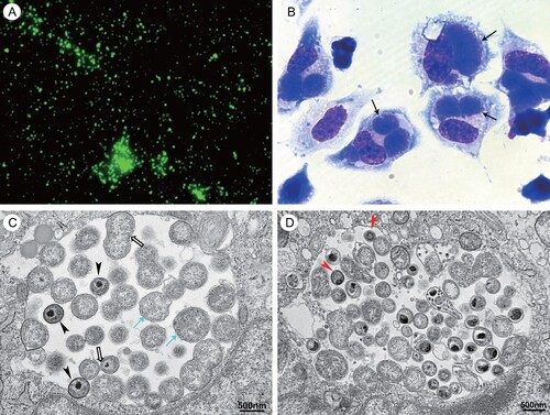 Figure 2. Photomicrographs of cells infected with C. psittaci LS strain. (A) Immunofluorescent staining with one patient’ serum under immunofluorescent microscopy at 400× magnification (Eclipse 80i, Nikon, Shanghai, China). (B) Wright-Giemsa staining under light microscopy at 1000× magnification (Eclipse 80i, Nikon, Shanghai, China). The inclusions of C. psittaci are indicated by black arrows. (C) The different morphological forms of C. psittaci present within a single inclusion in the infected cell under electron microscopy (FEI Tecnai12, Thermo Fisher, Waltham, MA). The cyan arrows indicated the reticulate bodies and the hollow arrows indicated the dividing reticulate bodies. The arrowhead indicated the intermediate bodies. (D) The red arrows indicated the elementary bodies under electron microscopy.
